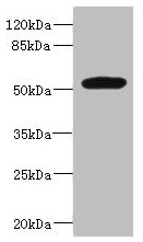 MARCO Antibody - Western blot All lanes: MARCO antibody at 1.97µg/ml + Jurkat whole cell lysate Secondary Goat polyclonal to rabbit IgG at 1/10000 dilution Predicted band size: 53, 44 kDa Observed band size: 53 kDa