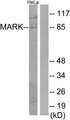 MARK1+2+3+4 Antibody - Western blot analysis of lysates from HeLa cells, using MARK Antibody. The lane on the right is blocked with the synthesized peptide.