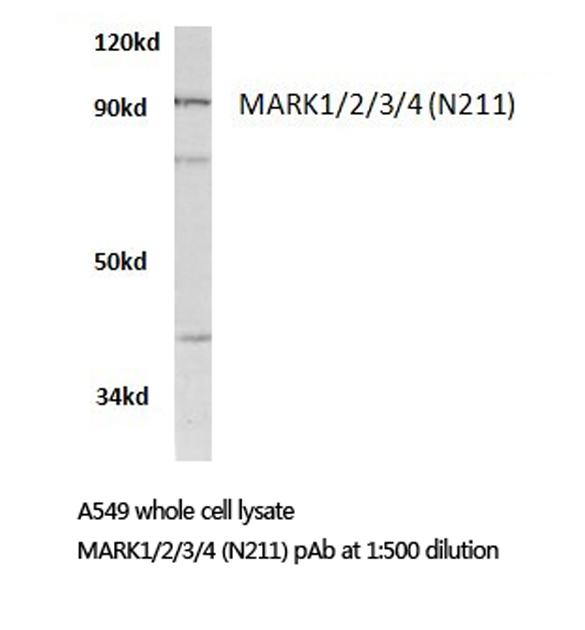 MARK1+2+3+4 Antibody - Western blot of MARK1/2/3/4 (N211) pAb in extracts from A549 cells.