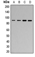 MARK1+2+3+4 Antibody - Western blot analysis of MARK expression in A431 (A); Jurkat (B); mouse heart (C); mouse brain (D) whole cell lysates.