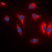 MARK1+2+3+4 Antibody - Immunofluorescent analysis of MARK staining in A431 cells. Formalin-fixed cells were permeabilized with 0.1% Triton X-100 in TBS for 5-10 minutes and blocked with 3% BSA-PBS for 30 minutes at room temperature. Cells were probed with the primary antibody in 3% BSA-PBS and incubated overnight at 4 deg C in a humidified chamber. Cells were washed with PBST and incubated with a DyLight 594-conjugated secondary antibody (red) in PBS at room temperature in the dark. DAPI was used to stain the cell nuclei (blue).
