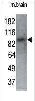 MARK1 / MARK Antibody - The anti-MARK1 N-term antibody is used in Western blot to detect MARK1 in P7 mouse whole brain lysate (60 ug). 1:250 dilution of anti-MARK1 antibody was used. Data and protocol kindly provided by DR. Shengli Zhao, M.D., Ph.D. of Duke University Medical Center.