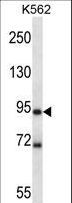 MARK1 / MARK Antibody - Mouse Mark1 Antibody western blot of K562 cell line lysates (35 ug/lane). The Mark1 antibody detected the Mark1 protein (arrow).