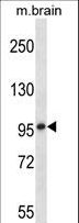 MARK1 / MARK Antibody - Mouse Mark1 Antibody western blot of mouse brain tissue lysates (35 ug/lane). The Mark1 antibody detected the Mark1 protein (arrow).