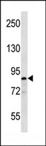 MARK1 / MARK Antibody - MARK Antibody (S658) western blot of T47D cell line lysates (35 ug/lane). The MARK antibody detected the MARK protein (arrow).