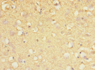 MARK1 / MARK Antibody - Immunohistochemistry of paraffin-embedded human brain tissue at dilution 1:100