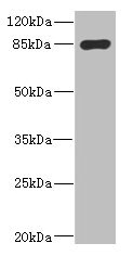 MARK1 / MARK Antibody - Western blot All Lanes: MARK1 antibody IgG at 2.65ug/ml+ Rat heart tissue Secondary Goat polyclonal to rabbit IgG at 1/10000 dilution Predicted band size: 90,73,85 kDa Observed band size: 89 kDa