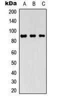 MARK2 Antibody - Western blot analysis of MARK2 expression in Jurkat (A); Raji (B); human heart (C) whole cell lysates.