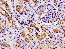 MARK2 Antibody - Immunohistochemistry image of paraffin-embedded human kidney tissue at a dilution of 1:100