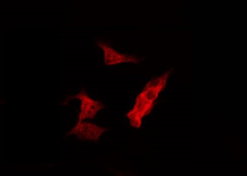 MARK2 Antibody - Staining HepG2 cells by IF/ICC. The samples were fixed with PFA and permeabilized in 0.1% Triton X-100, then blocked in 10% serum for 45 min at 25°C. The primary antibody was diluted at 1:200 and incubated with the sample for 1 hour at 37°C. An Alexa Fluor 594 conjugated goat anti-rabbit IgG (H+L) Ab, diluted at 1/600, was used as the secondary antibody.