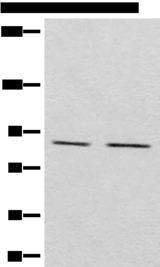 MARK2 Antibody - Western blot analysis of Raji and A431 cell lysates  using MARK2 Polyclonal Antibody at dilution of 1:800