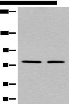 MARK2 Antibody - Western blot analysis of A431 and Raji cell lysates  using MARK2 Polyclonal Antibody at dilution of 1:550