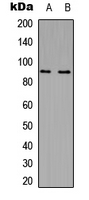 MARK2 Antibody - Western blot analysis of MARK2 expression in Jurkat (A); NIH3T3 (B) whole cell lysates.