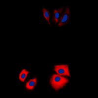 MARK2 Antibody - Immunofluorescent analysis of MARK2 staining in Jurkat cells. Formalin-fixed cells were permeabilized with 0.1% Triton X-100 in TBS for 5-10 minutes and blocked with 3% BSA-PBS for 30 minutes at room temperature. Cells were probed with the primary antibody in 3% BSA-PBS and incubated overnight at 4 deg C in a humidified chamber. Cells were washed with PBST and incubated with a DyLight 594-conjugated secondary antibody (red) in PBS at room temperature in the dark. DAPI was used to stain the cell nuclei (blue).