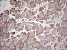 MARK4 Antibody - Immunohistochemical staining of paraffin-embedded Human pancreas tissue within the normal limits using anti-MARK4 mouse monoclonal antibody. (Heat-induced epitope retrieval by 1mM EDTA in 10mM Tris buffer. (pH8.5) at 120°C for 3 min. (1:150)