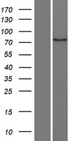 MARK4 Protein - Western validation with an anti-DDK antibody * L: Control HEK293 lysate R: Over-expression lysate