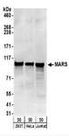 MARS Antibody - Detection of Human MARS by Western Blot. Samples: Whole cell lysate (50 ug) from 293T, HeLa, and Jurkat cells. Antibodies: Affinity purified rabbit anti-MARS antibody used for WB at 0.1 ug/ml. Detection: Chemiluminescence with an exposure time of 30 seconds.