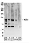 MARS Antibody - Detection of Human and Mouse MARS by Western Blot. Samples: Whole cell lysate (50 ug) from 293T, HeLa, Jurkat, mouse TCMK-1, and mouse NIH3T3 cells. Antibodies: Affinity purified rabbit anti-MARS antibody used for WB at 0.4 ug/ml. Detection: Chemiluminescence with an exposure time of 3 minutes.