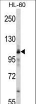 MARS Antibody - Western blot of MARS Antibody in HL-60 cell line lysates (35 ug/lane). cMARS (arrow) was detected using the purified antibody.