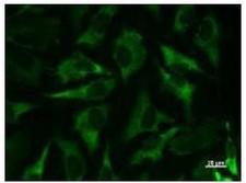 MARS Antibody - Immunofluorescent staining using MARS antibody. Immunostaining analysis in HeLa cells. HeLa cells were fixed with 4% paraformaldehyde and permeabilized with 0.01% Triton-X100 in PBS. The cells were immunostained with anti-MARS antibody.
