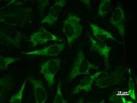 MARS Antibody - Immunostaining analysis in HeLa cells. HeLa cells were fixed with 4% paraformaldehyde and permeabilized with 0.1% Triton X-100 in PBS. The cells were immunostained with anti-MARS mAb.