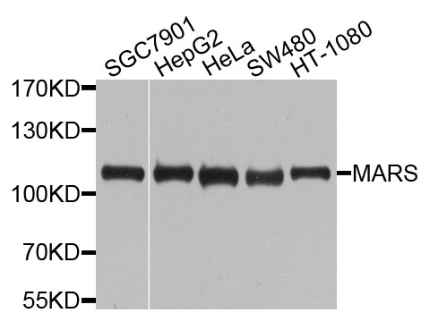 MARS Antibody - Western blot analysis of extracts of various cells.