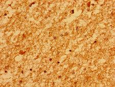 MARS2 Antibody - Immunohistochemistry image of paraffin-embedded human brain tissue at a dilution of 1:100