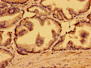 MARS2 Antibody - Immunohistochemistry image of paraffin-embedded human prostate tissue at a dilution of 1:100