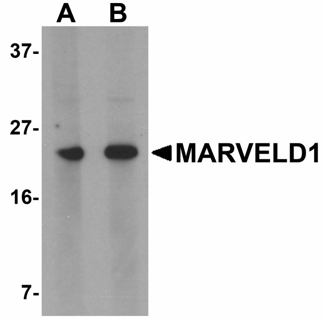 MARVELD1 Antibody - Western blot of MARVELD1 in mouse heart tissue lysate with MARVELD1 antibody at (A) 1 and (B) 2 ug/ml.