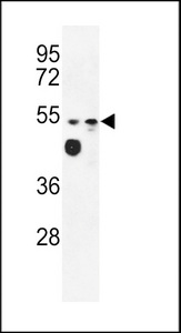 MARVELD2 / Tricellulin Antibody - Western blot of MALD2 Antibody in WiDr, MDA-MB231 cell line lysates (35 ug/lane). MALD2 (arrow) was detected using the purified antibody.