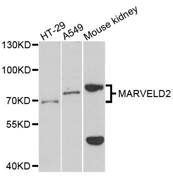 MARVELD2 / Tricellulin Antibody - Western blot analysis of extracts of various cell lines, using MARVELD2 antibody at 1:1000 dilution. The secondary antibody used was an HRP Goat Anti-Rabbit IgG (H+L) at 1:10000 dilution. Lysates were loaded 25ug per lane and 3% nonfat dry milk in TBST was used for blocking. An ECL Kit was used for detection and the exposure time was 60s.