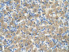MARVELD3 Antibody - MARVELD3 antibody MARVELD3(MARVEL domain containing 3) Antibody was used in IHC to stain formalin-fixed, paraffin-embedded human liver.  This image was taken for the unconjugated form of this product. Other forms have not been tested.