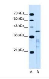 MARVELD3 Antibody - Lane A: Marker. Lane B: Jurkat cell lysate. Antibody concentration: 0.25 ug/ml. Gel concentration: 12%.  This image was taken for the unconjugated form of this product. Other forms have not been tested.