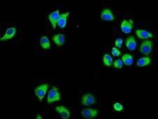 MARVELD3 Antibody - Immunofluorescence staining of Hela cells diluted at 1:133, counter-stained with DAPI. The cells were fixed in 4% formaldehyde, permeabilized using 0.2% Triton X-100 and blocked in 10% normal Goat Serum. The cells were then incubated with the antibody overnight at 4°C.The Secondary antibody was Alexa Fluor 488-congugated AffiniPure Goat Anti-Rabbit IgG (H+L).
