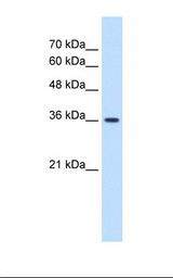 MAS1 / MAS Antibody - HepG2 cell lysate. Antibody concentration: 1.25 ug/ml. Gel concentration: 12%.  This image was taken for the unconjugated form of this product. Other forms have not been tested.