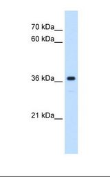 MAS1 / MAS Antibody - HepG2 cell lysate. Antibody concentration: 0.25 ug/ml. Gel concentration: 12%.  This image was taken for the unconjugated form of this product. Other forms have not been tested.