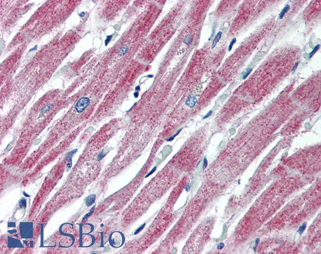 MAS1 / MAS Antibody - Anti-MAS1 antibody IHC of human heart. Immunohistochemistry of formalin-fixed, paraffin-embedded tissue after heat-induced antigen retrieval. Antibody concentration 5 ug/ml.  This image was taken for the unconjugated form of this product. Other forms have not been tested.