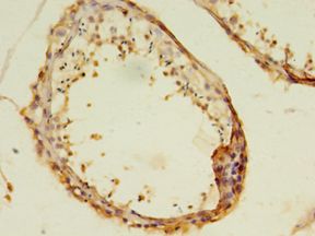 MAS1 / MAS Antibody - Immunohistochemistry of paraffin-embedded human testis using antibody at 1: 100 dilution.  This image was taken for the unconjugated form of this product. Other forms have not been tested.