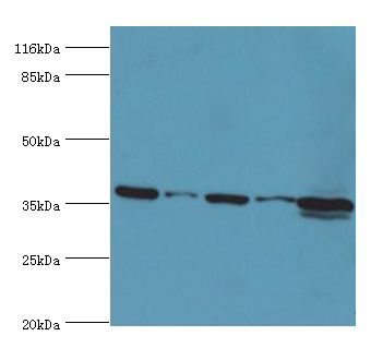 MAS1 / MAS Antibody - Western blot. All lanes: MAS1 antibody at 2 ug/ml. Lane 1: 293t cells Lane 2: COLO320 cells Lane 3: HeLa cells Lane 4: HepG2 cells Lane 5: mouse liver tissue. Secondary antibody: goat polyclonal to rabbit at 1:10000 dilution. Predicted band size: 37 kDa. Observed band size: 37 kDa.  This image was taken for the unconjugated form of this product. Other forms have not been tested.