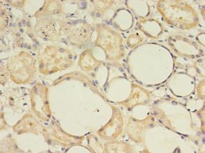MAS1 / MAS Antibody - Immunohistochemistry of paraffin-embedded human kidney using antibody at 1:100 dilution.  This image was taken for the unconjugated form of this product. Other forms have not been tested.