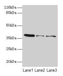 MAS1 / MAS Antibody - Western blot All lanes: MAS1 antibody at 2µg/ml Lane 1: 293t cells Lane 2: Colo320 cells Lane 3: Hela cells Lane 4: HepG2 cells Lane 5: Mouse liver tissue Secondary Goat polyclonal to rabbit IgG at 1/10000 dilution Predicted band size: 37 kDa Observed band size: 37 kDa