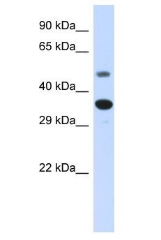 MAS1 / MAS Antibody - MAS1 / MAS antibody Western Blot of Fetal Liver. Antibody dilution: 1 ug/ml.  This image was taken for the unconjugated form of this product. Other forms have not been tested.