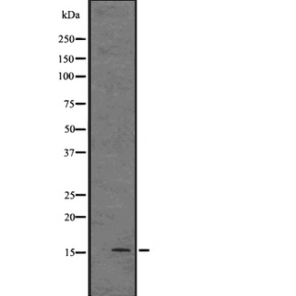 MAS1 / MAS Antibody - Western blot analysis of MAS expression in human fetal liver tissue lysate. The lane on the left is treated with the antigen-specific peptide.