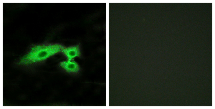 MAS1L / MRG Antibody - Immunofluorescence analysis of HeLa cells, using MAS1L Antibody. The picture on the right is blocked with the synthesized peptide.