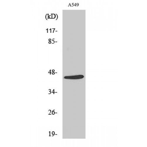 MASP1 / MASP Antibody - Western blot of Cleaved-MASP-1 HC (R448) antibody