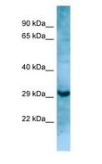 MASP1 / MASP Antibody - MASP1 / MASP antibody Western Blot of HT1080.  This image was taken for the unconjugated form of this product. Other forms have not been tested.