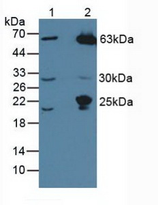 MASP1 / MASP Antibody - Western Blot; Lane1: Human Hela Cells; Lane2: Mouse Liver Tissue.