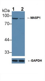 MASP1 / MASP Antibody - Knockout Varification: Lane 1: Wild-type Hela cell lysate; Lane 2: MASP1 knockout Hela cell lysate; Predicted MW: 80,82kDa Observed MW: 90kDa Primary Ab: 1µg/ml Rabbit Anti-Mouse MASP1 Antibody Second Ab: 0.2µg/mL HRP-Linked Caprine Anti-Rabbit IgG Polyclonal Antibody
