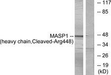 MASP1 / MASP Antibody - Western blot analysis of extracts from A549 cells, treated with etoposide (25uM, 24hours), using MASP1 (heavy chain, Cleaved-Arg448) antibody.