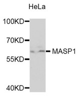 MASP1 / MASP Antibody - Western blot analysis of extracts of HeLa cells.